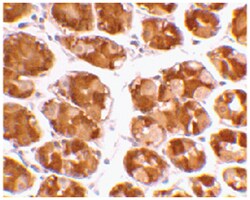 TRIM5 Rabbit anti-Human, Polyclonal Antibody, Abnova 100&mu;g; Unlabeled:Antibodies,