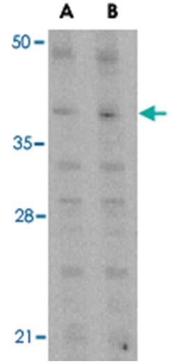 MCL1 Rabbit anti-Human, Mouse, Rat, Polyclonal Antibody, Abnova 100&mu;g;