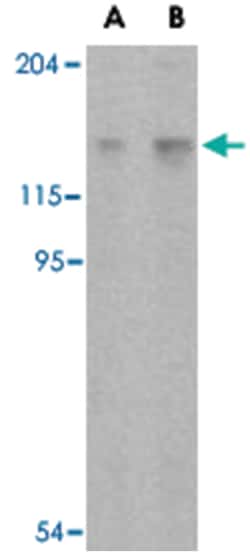 4932417H02Rik (Rptor), Rabbit, Polyclonal Antibody, Abnova 100 &mu;g | Buy Online | Abnova | Fisher Scientific