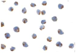 ERN1 Rabbit anti-Human, Mouse, Rat, Polyclonal Antibody, Abnova 100 &mu;g | Buy Online | Abnova | Fisher Scientific