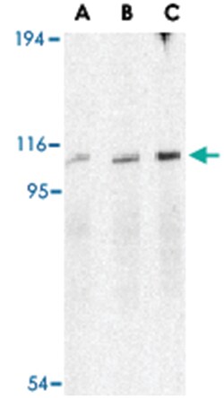 ERN1 Rabbit anti-Human, Mouse, Rat, Polyclonal Antibody, Abnova 100 &mu;g | Buy Online | Abnova | Fisher Scientific