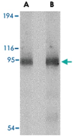 CD180 Rabbit anti-Human, Mouse, Polyclonal Antibody, Abnova 100&mu;g; Unlabeled:Antibodies,