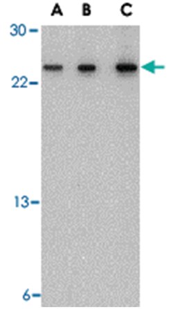 TSLP, Rabbit, Polyclonal Antibody, Abnova 100&mu;g; Unlabeled:Antibodies,