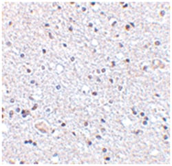 TSLP, Rabbit, Polyclonal Antibody, Abnova 100&mu;g; Unlabeled:Antibodies,