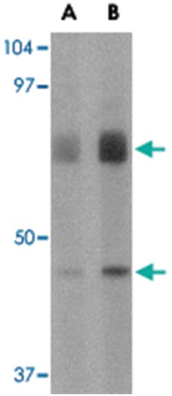 DHX58 Rabbit anti-Human, Mouse, Rat, Polyclonal Antibody, Abnova 100&mu;g;