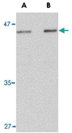 LASS5 Rabbit anti-Human, Polyclonal Antibody, Abnova 100&mu;g; Unlabeled:Antibodies,