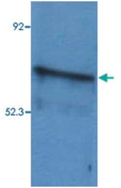 BLNK Rabbit anti-Human, Mouse, Polyclonal Antibody, Abnova 100&mu;g; Unlabeled:Anticuerpos