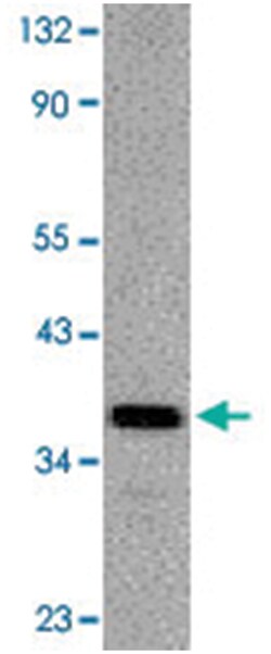Dffa Rabbit anti-Mouse, Polyclonal Antibody, Abnova 100 &mu;g | Buy Online | Abnova | Fisher Scientific