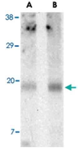 Birc5 Rabbit anti-Mouse, Polyclonal Antibody, Abnova 100 &mu;g | Buy Online | Abnova | Fisher Scientific