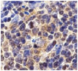 Birc5 Rabbit anti-Mouse, Polyclonal Antibody, Abnova 100 &mu;g | Buy Online | Abnova | Fisher Scientific
