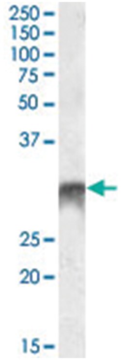 DLX5, Goat, Polyclonal Antibody, Abnova 100 &mu;g | Buy Online | Abnova | Fisher Scientific