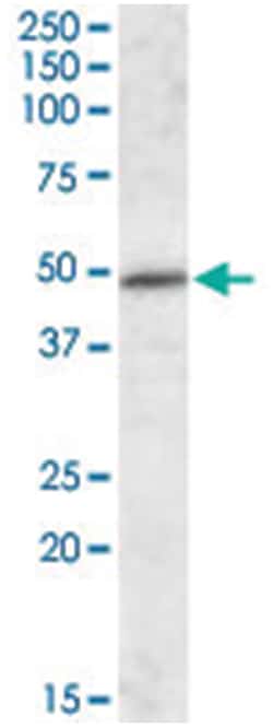 IFT57, Goat, Polyclonal Antibody, Abnova 100&mu;g; Unlabeled:Antibodies,