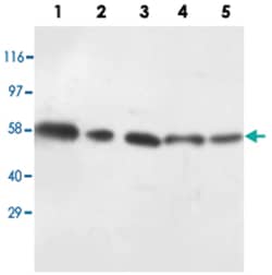 AKT1/AKT2 Rabbit anti-Human, Mouse, Rat, Polyclonal Antibody, Abnova 100 &mu;g | Buy Online | Abnova Corporation | Fisher Scientific