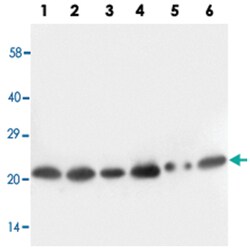 SCN1B, Rabbit, Polyclonal Antibody, Abnova 100&mu;g; Unlabeled:Antibodies,