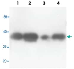 TNFAIP1, Rabbit, Polyclonal Antibody, Abnova 100&mu;g; Unlabeled:Antibodies,