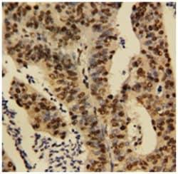 TNFAIP1, Rabbit, Polyclonal Antibody, Abnova 100&mu;g; Unlabeled:Antibodies,