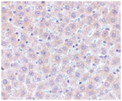 TNFSF11 Rabbit anti-Human, Mouse, Rat, Polyclonal Antibody, Abnova 100 &mu;g | Buy Online | Abnova | Fisher Scientific