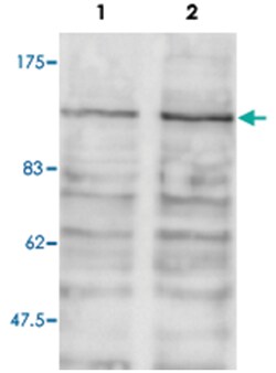 Brd2, Rabbit, Polyclonal Antibody, Abnova 100 &mu;L | Buy Online | Abnova | Fisher Scientific