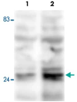 Fkbp3, Rabbit, Polyclonal Antibody, Abnova 100&mu;L; Unlabeled:Antibodies,