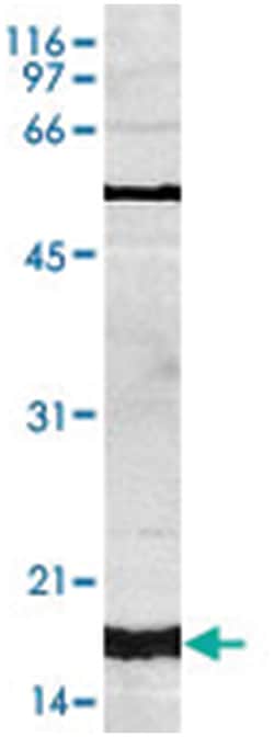 H3K4me3, Rabbit, Polyclonal Antibody, Abnova 50 &mu;g | Buy Online | Abnova Corporation | Fisher Scientific
