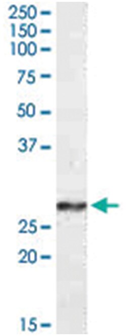 NDUFS3, Goat, Polyclonal Antibody, Abnova 100&mu;g; Unlabeled:Antibodies,