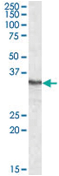 PPP4C, Goat, Polyclonal Antibody, Abnova 100 &mu;g | Buy Online | Abnova Corporation | Fisher Scientific