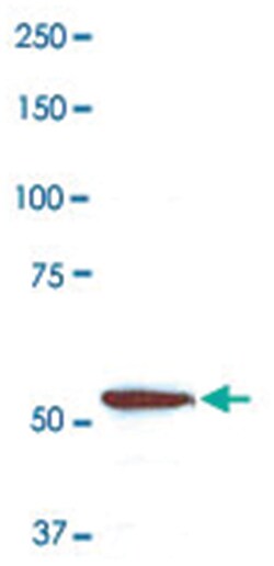 CORO1A Rabbit anti-Human, Mammals, Polyclonal Antibody, Abnova 100&mu;L;