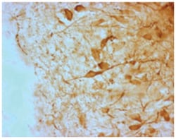 Agrp, Guinea Pig, Polyclonal Antibody, Abnova 50&mu;L; Unlabeled:Antibodies,