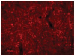 Agrp, Guinea Pig, Polyclonal Antibody, Abnova 50&mu;L; Unlabeled:Antibodies,