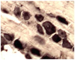 App Rabbit anti-Mouse, Rat, Polyclonal Antibody, Abnova 100 &mu;L | Buy Online | Abnova Corporation | Fisher Scientific