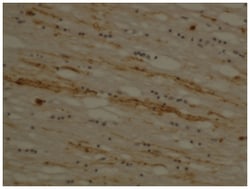 MBP Rabbit anti-Guinea pig, Human, Rat, Polyclonal Antibody, Abnova 100&mu;L;