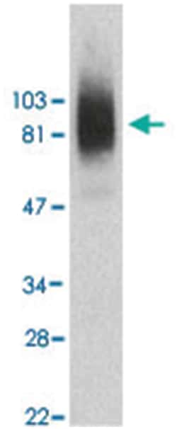 SIRPA, Rabbit, Polyclonal Antibody, Abnova 100 &mu;g | Buy Online | Abnova Corporation | Fisher Scientific