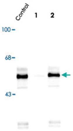 TPH1 (phospho S260), Rabbit, Polyclonal Antibody, Abnova 100 &mu;L | Buy Online | Abnova Corporation | Fisher Scientific