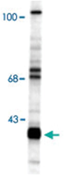 CHAT Rabbit anti-Human, Polyclonal Antibody, Abnova 100&mu;L; Unlabeled:Antibodies,