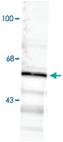 Gabra6 Rabbit anti-Rat, Polyclonal Antibody, Abnova 50&mu;L; Unlabeled:Antibodies,
