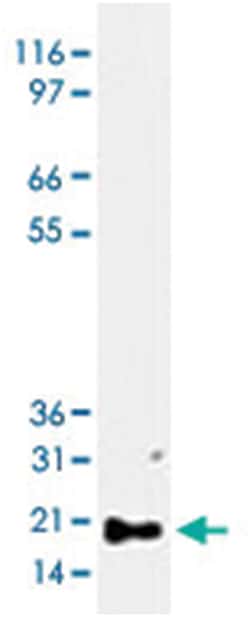Bax, Rabbit, Polyclonal Antibody, Abnova 50&mu;L; Unlabeled:Antibodies,