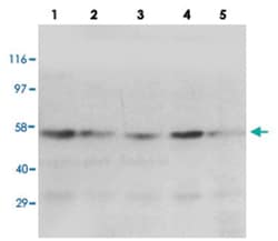 PPARG Rabbit anti-Human, Polyclonal Antibody, Abnova 100&mu;g; Unlabeled:Antibodies,