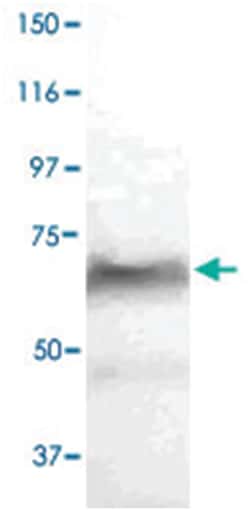 SELE Rabbit anti-Bovine, Human, Mouse, Rat, Polyclonal Antibody, Abnova
