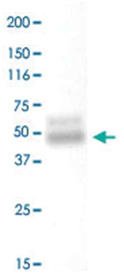 SLC10A4 Rabbit anti-Mouse, Rat, Polyclonal Antibody, Abnova 100 &mu;g | Buy Online | Abnova | Fisher Scientific