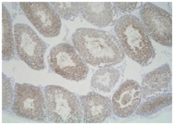 Slc25a19, Rabbit, Polyclonal Antibody, Abnova 25&mu;g; Unlabeled:Antibodies,