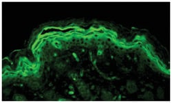 Erk1/2, Rabbit, Polyclonal Antibody, Abnova 100 &mu;L | Buy Online | Abnova Corporation | Fisher Scientific