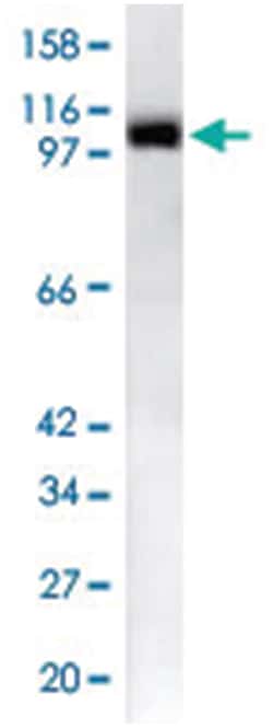LSD1, Rabbit, Polyclonal Antibody, Abnova 100 &mu;L | Buy Online | Abnova Corporation | Fisher Scientific