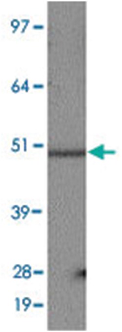 SLC2A9 Rabbit anti-Human, Polyclonal Antibody, Abnova 100 &mu;L | Buy Online | Abnova | Fisher Scientific