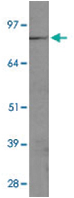 FER Rabbit anti-Dog, Human, Mouse, Polyclonal Antibody, Abnova 100&mu;L;