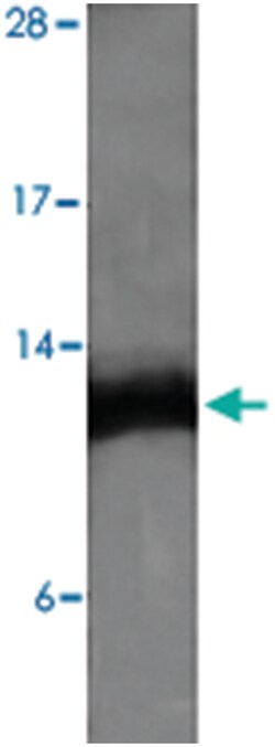ENHO Rabbit anti-Bovine, Human, Mouse, Rat, Polyclonal Antibody, Abnova