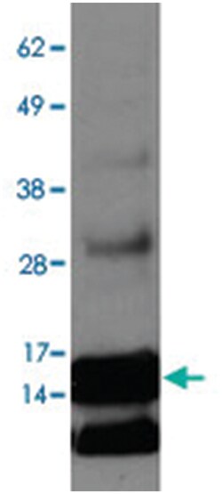 ENHO Rabbit anti-Bovine, Human, Mouse, Rat, Polyclonal Antibody, Abnova