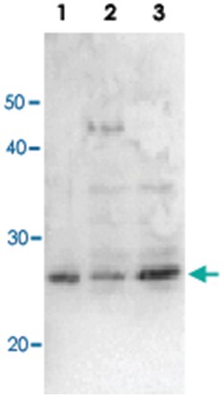 Escherichia coli RuvA, Rabbit, Polyclonal Antibody, Abnova 100 &mu;L | Buy Online | Abnova | Fisher Scientific