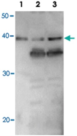 Escherichia coli RuvB, Rabbit, Polyclonal Antibody, Abnova 100 &mu;L | Buy Online | Abnova | Fisher Scientific