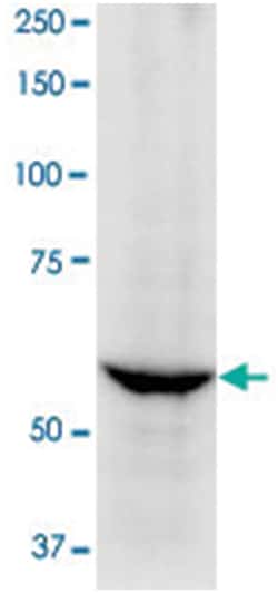 Lbr, Rabbit, Polyclonal Antibody, Abnova 50&mu;g; Unlabeled:Antibodies,