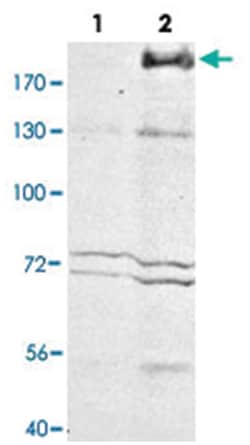 Mrc1, Rabbit, Polyclonal Antibody, Abnova 50 &mu;L | Buy Online | Abnova | Fisher Scientific